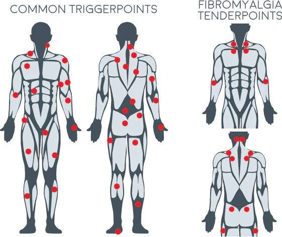 Trigger Point Release Massage in Practice